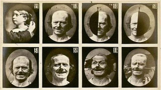Illustration for article titled The quest for the perfect smile required electrocuting people's faces